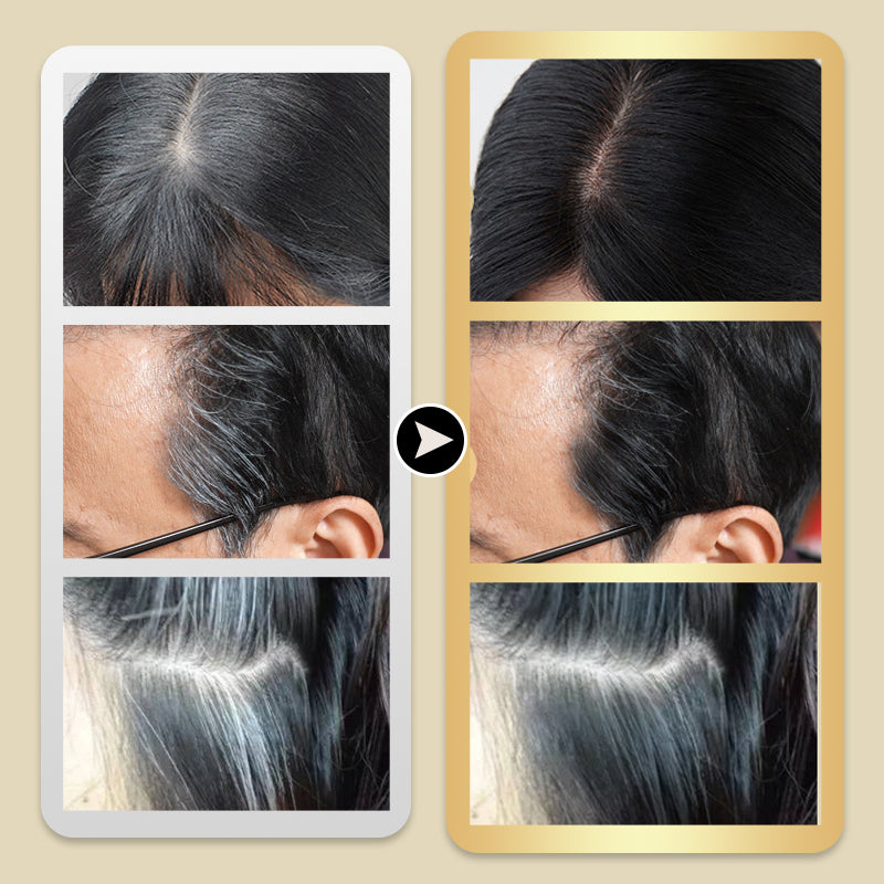 🔥1 KAUFEN, 1 GRATIS🎁Haarfärbemittel mit integriertem Kamm | 🌿 Sichere und sanfte Formel⚡ Schnelle Abdeckung grauer Haare Für zu Hause und unterwegs geeignet