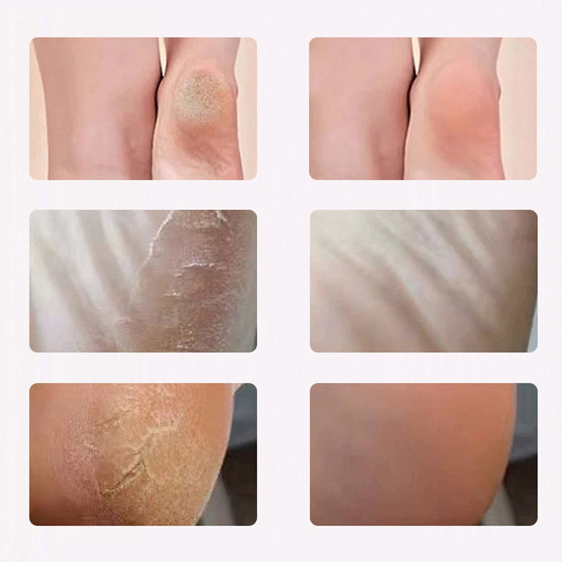 💥Elektrischer Fußschrubber für glatte, gesunde Haut