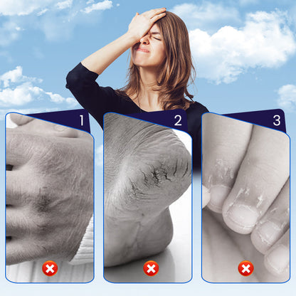 Rissige-Haut-Reparaturpflaster für Hände & Füße (50 % RABATT)