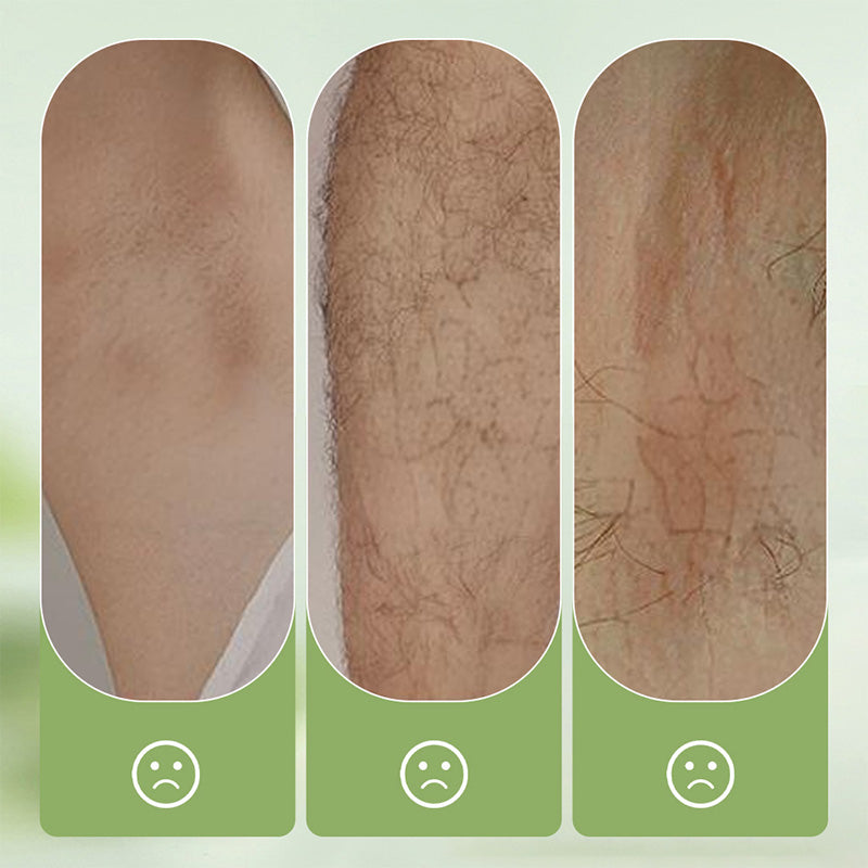 ✨Sanftes und hautfreundliches Haarentfernungsset (Haarentfernungscreme + Rasierer) | Zeitlich begrenztes Angebot 🎁
